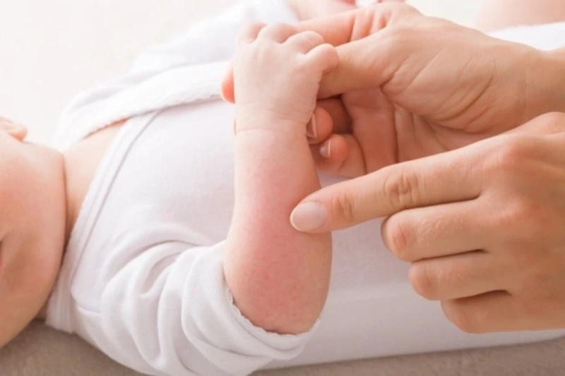 cara menghilangkan bentol alergi pada bayi cara menghilangkan bentol alergi pada bayi